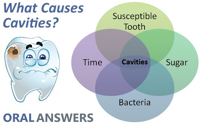 Dental Caries Prevention And Treatment Dentalorgcom